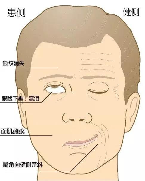 缺觉的危害，全身炎症状态的悄然侵袭