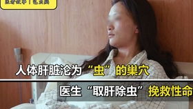 全球首例奇迹，同时换脸换手男子喜结良缘